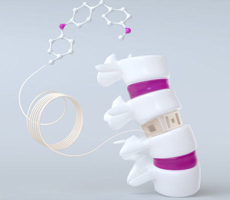 Evonik Series Filaments